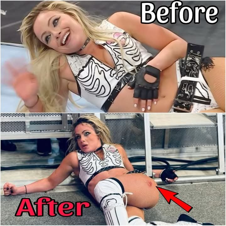 Liv Morgan Breaks Silence With Brutal Injury Update Following Elimination Chamber