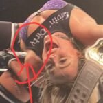 Tragedy in the Ring: Liv Morgan Suffers Serious Shoulder Injury During WWE Raw Match