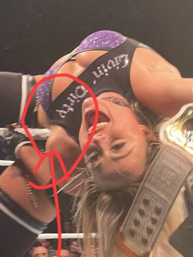 Tragedy in the Ring: Liv Morgan Suffers Serious Shoulder Injury During WWE Raw Match