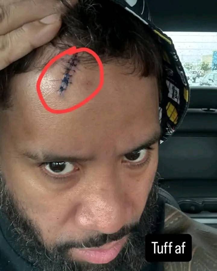 Main Event Jey Uso Requires Stitches After Accidental Injury at WrestlePalooza